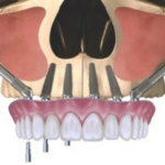 image (2)